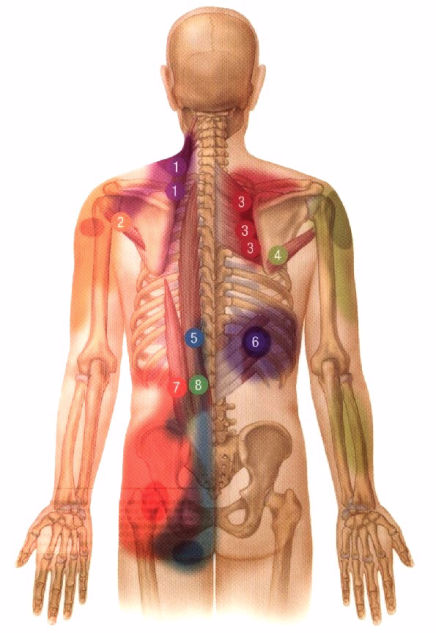 Les points trigger et points Knap Qu'est-ce que les points trigger et points Knap?